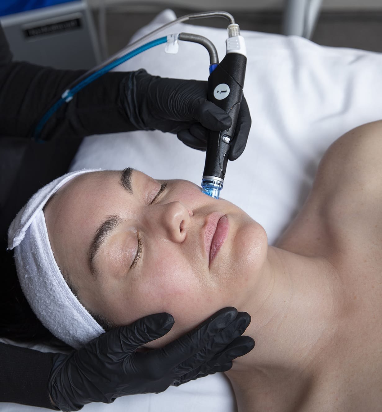 Hydrofacial skin treatment at Derma Clinic Group