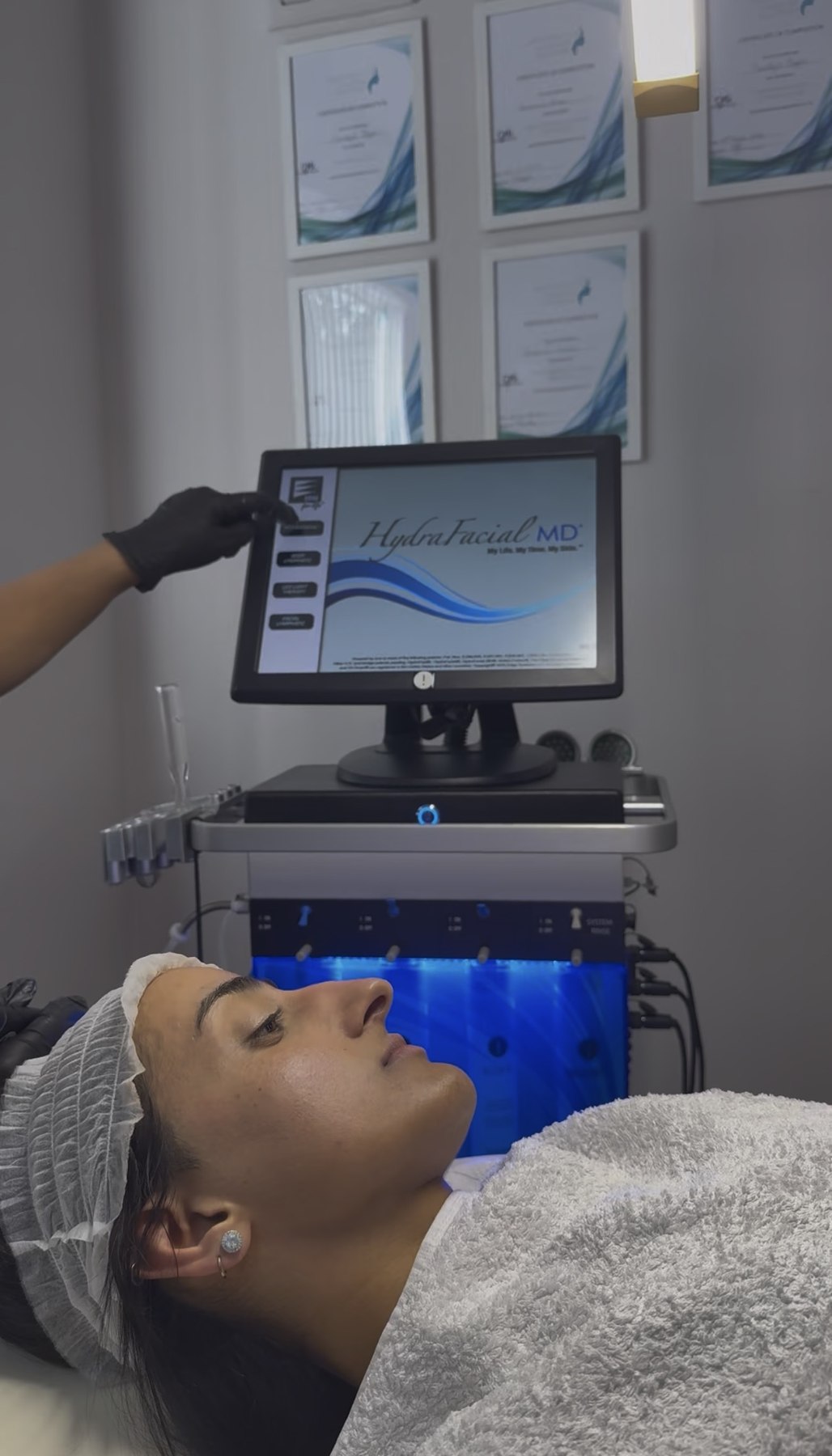 Hydrofacial treatment