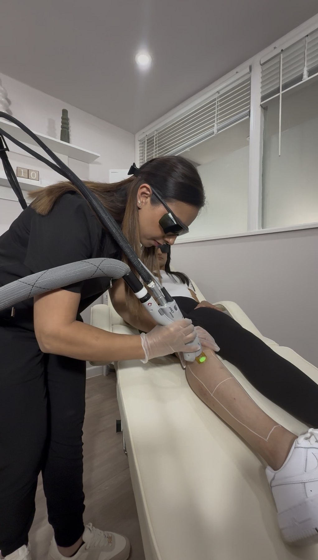 Laser hair removal treatment