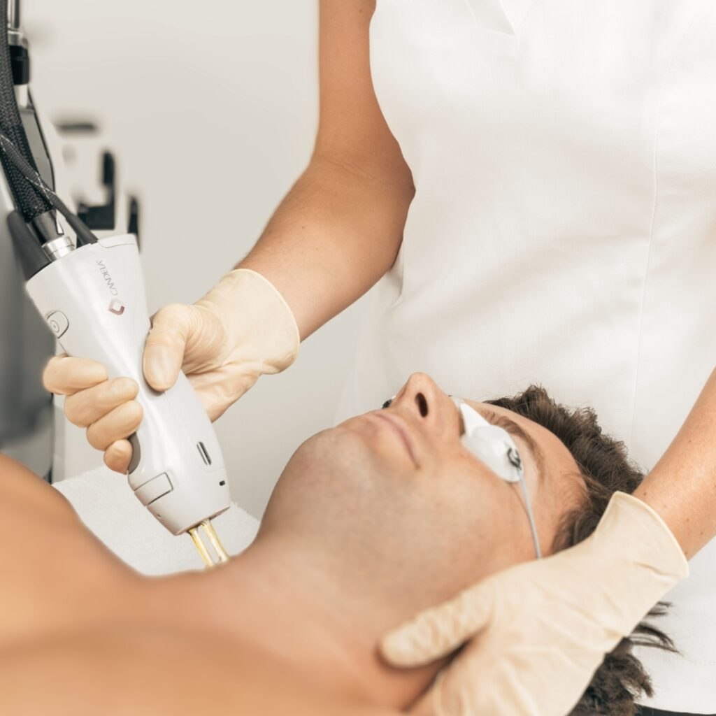 Men's laser hair removal treatment